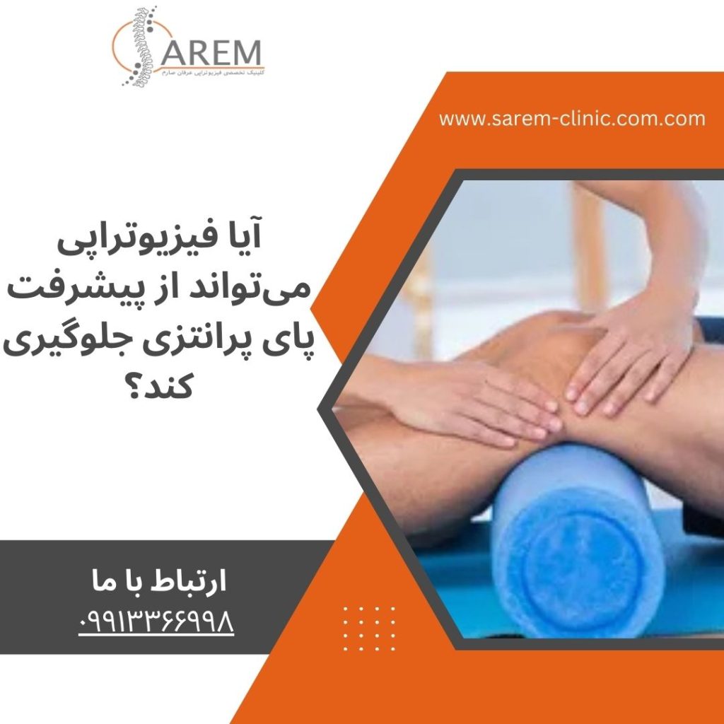 درمان پای پرانتزی با فیزیوتراپی