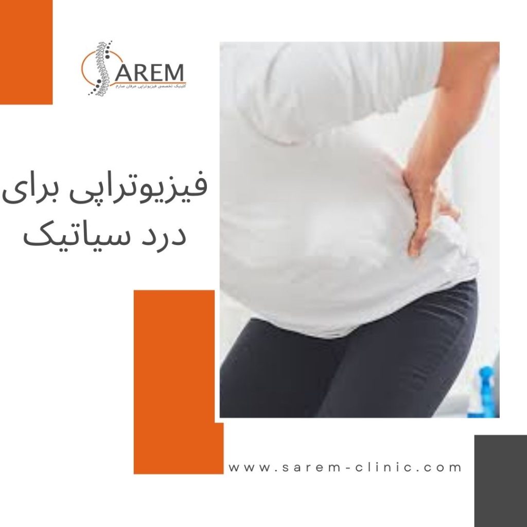 فیزیوتراپی برای درد سیاتیک