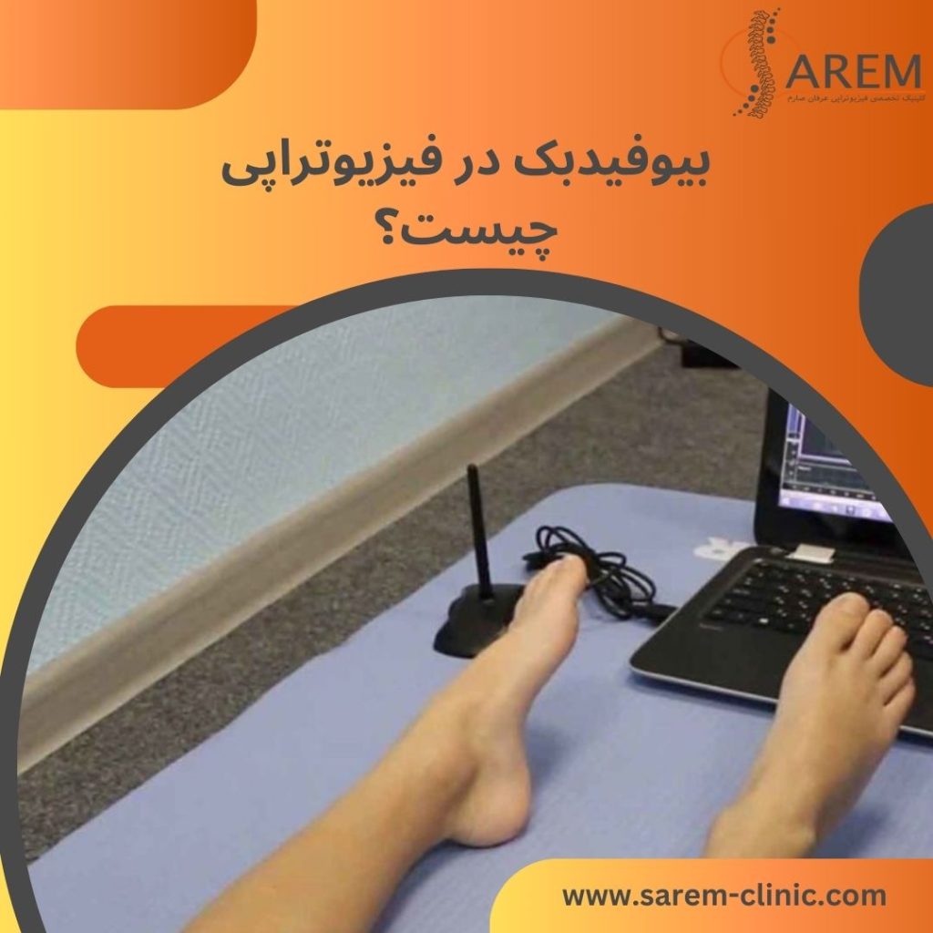 بیوفیدبک در فیزیوتراپی