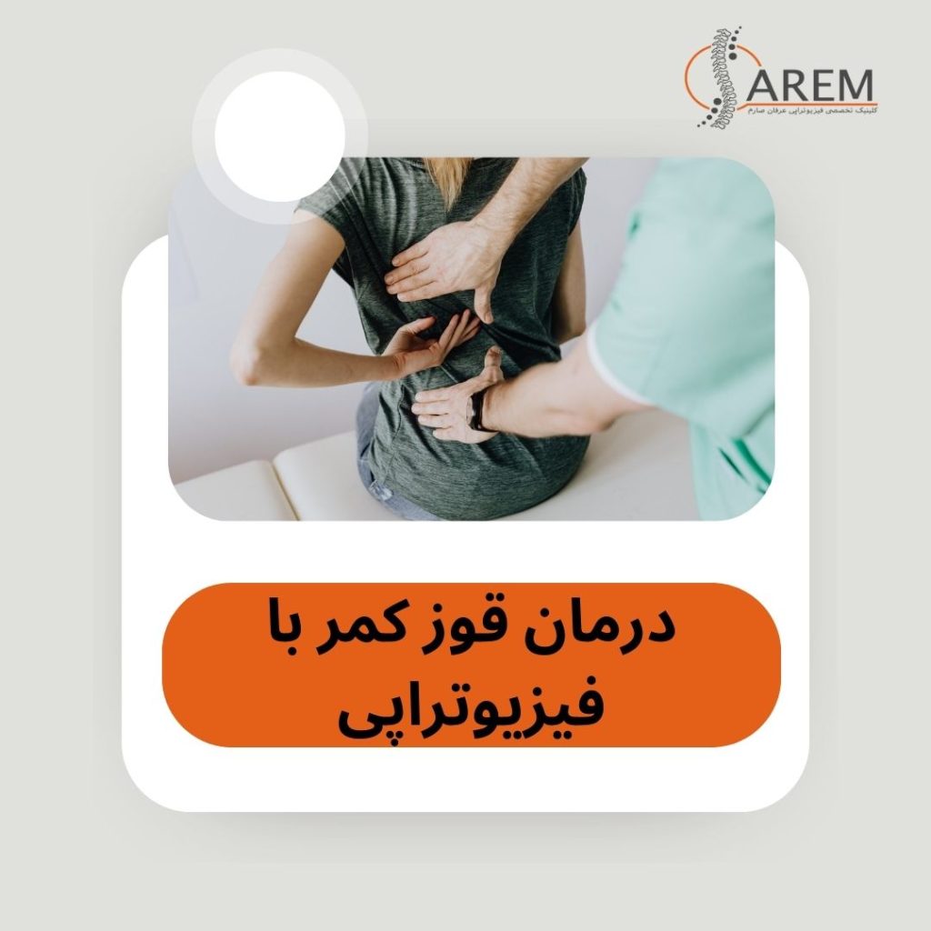درمان قوز کمر با فیزیوتراپی