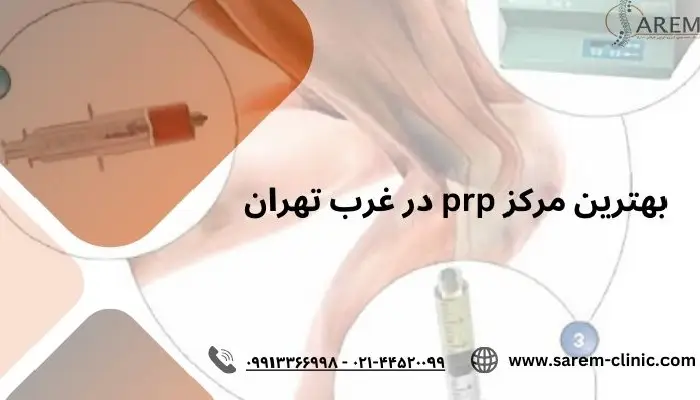 بهترین مرکز prp در غرب تهران