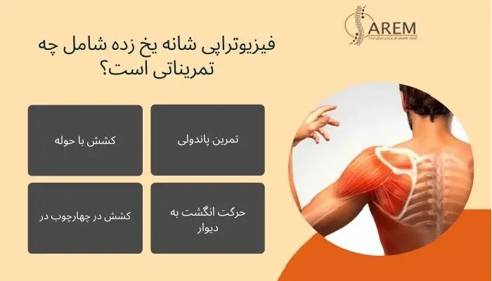 فیزیوتراپی شانه یخ زده