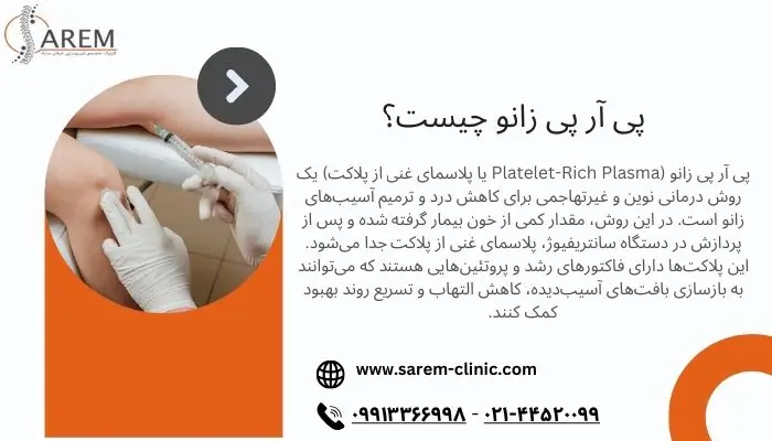 پی آر پی زانو