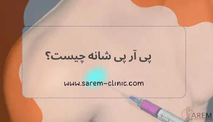 پی آر پی شانه