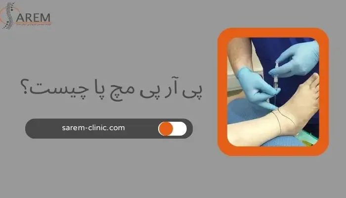 پی آر پی مچ پا