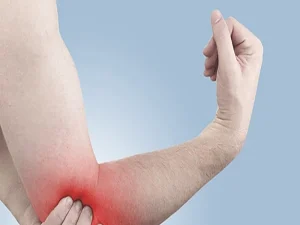 فیزیوتراپی شکستگی آرنج