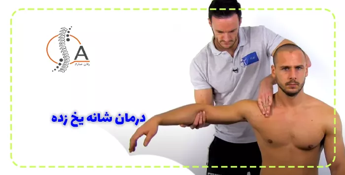 درمان شانه یخ زده