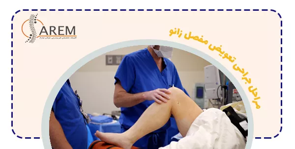 مراحل جراحی تعویض مفصل زانو