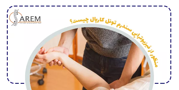 منظور از فیزیوتراپی سندرم تونل کارپال چیست؟
