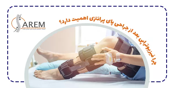 چرا فیزیوتراپی بعد از جراحی پای پرانتزی اهمیت دارد؟