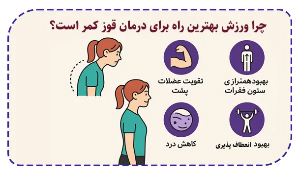 چرا ورزش بهترین راه برای درمان قوز کمر است؟