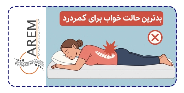 بدترین حالت خواب برای کمردرد کدام است؟